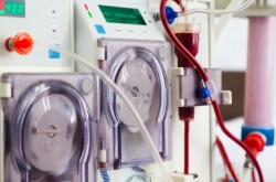 Fresenius dialysis