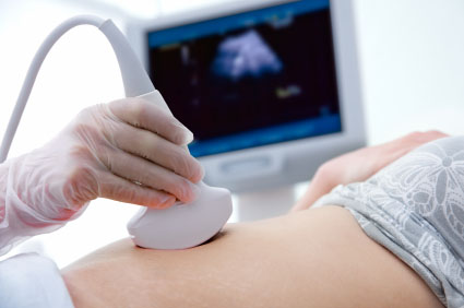 Mirena IUD birth control lawsuit