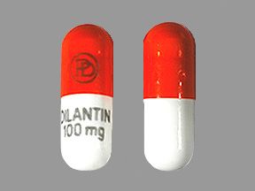 Dilantin-long-term-exposure