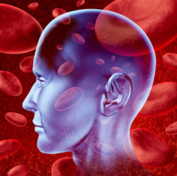Pradaxa Stroke Lawsuit