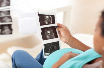 Zoloft birth defect lawsuit