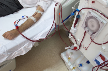 GranuFlo Kidney Dialysis Lawsuit