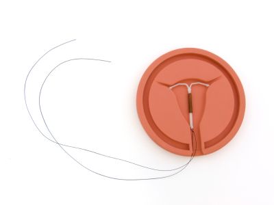 intrauterine device (IUD)