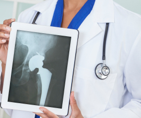 Stryker hip replacement complications