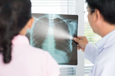 asbestos lung cancer