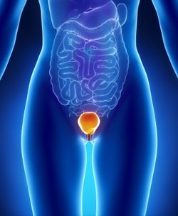 Transvaginal Mesh Lawsuit