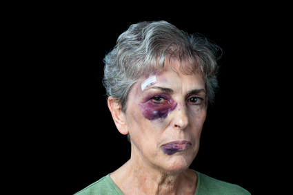 Beaten old woman