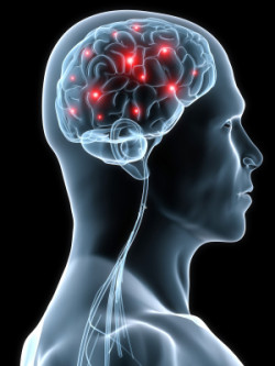NCAA Concussion MDL