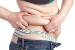 tummy tuck, body lift, body contouring, skin removal surgery