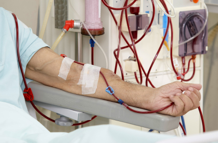 dialysis 2