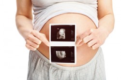 SSRI birth defect study SSRI birth defect study