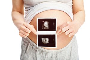 birth defect lawsuit