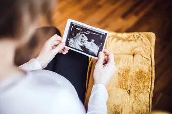 Zoloft birth defects lawsuit