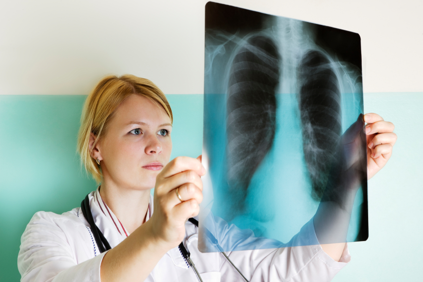 asbestos exposure lawsuit