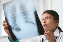 lung cancer, mesothelioma