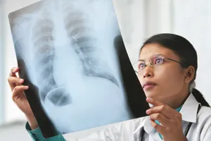 lung cancer, mesothelioma