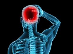 Pseudotumor Cerebri