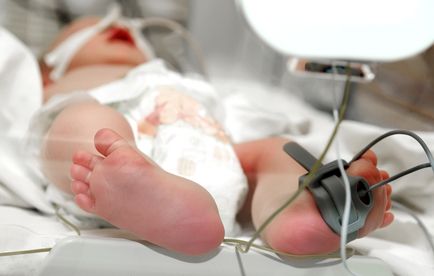 birth injury medical malpractice