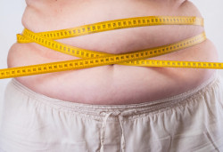 weight loss surgery