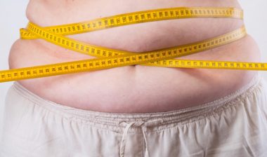 weight loss surgery