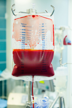 Xarelto bleeding