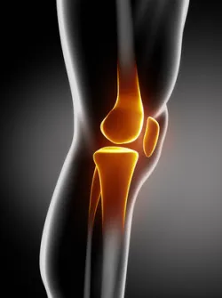 knee implant