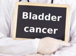 Actos Bladder Cancer bladder cancer actos  Actos lawsuit