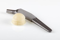 hip-replacement-metal
