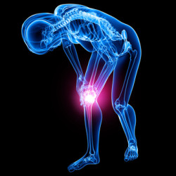 knee implant knee replacement