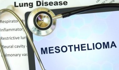 mesothelioma survivor
