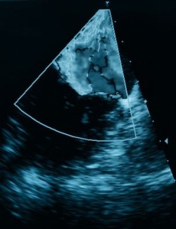 birth defects