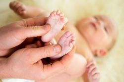 birth-defect-baby