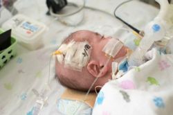 birth-injury-baby