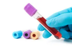 Blood test