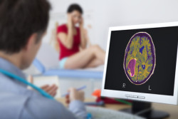 brain tumor symptoms