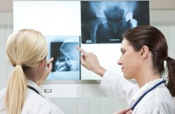 hip-xray-doctors