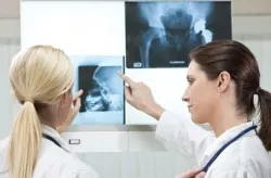 hip-xray-doctors