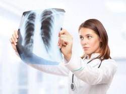 lung-xray-asbestos