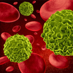 cancer cells