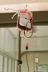 eliquis-transfusion-blood