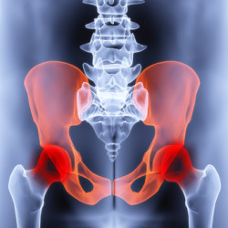 hip-implant-pain