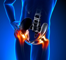 pinnacle hip implant pain