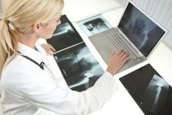 hip-replacement-xrays