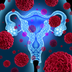 Uterine Cancer Power Morcellator