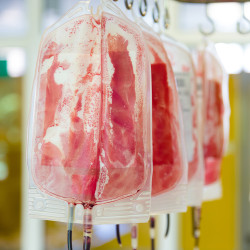 a blood bag for infusion into a clinic. donor blood is administered.
