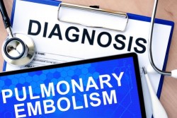 ivc-pulmonary-embolism