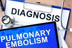ivc-pulmonary-embolism