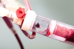 pradaxa-bleeding-complications