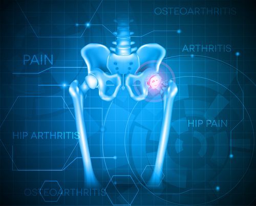 Human pelvis hip pain, abstract blue background. Hip arthritis