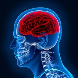 lovaza-subdural-hematoma